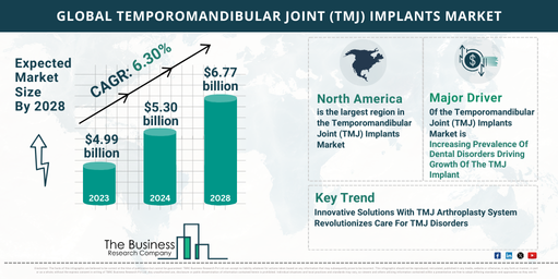 temporomandibular joint (tmj) implants