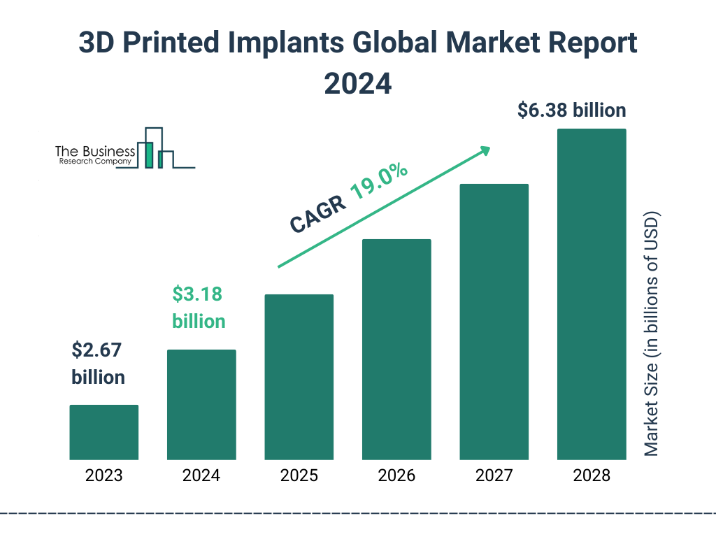 Global 3D Printed Implants Market Size 2023 to 2028: Graph