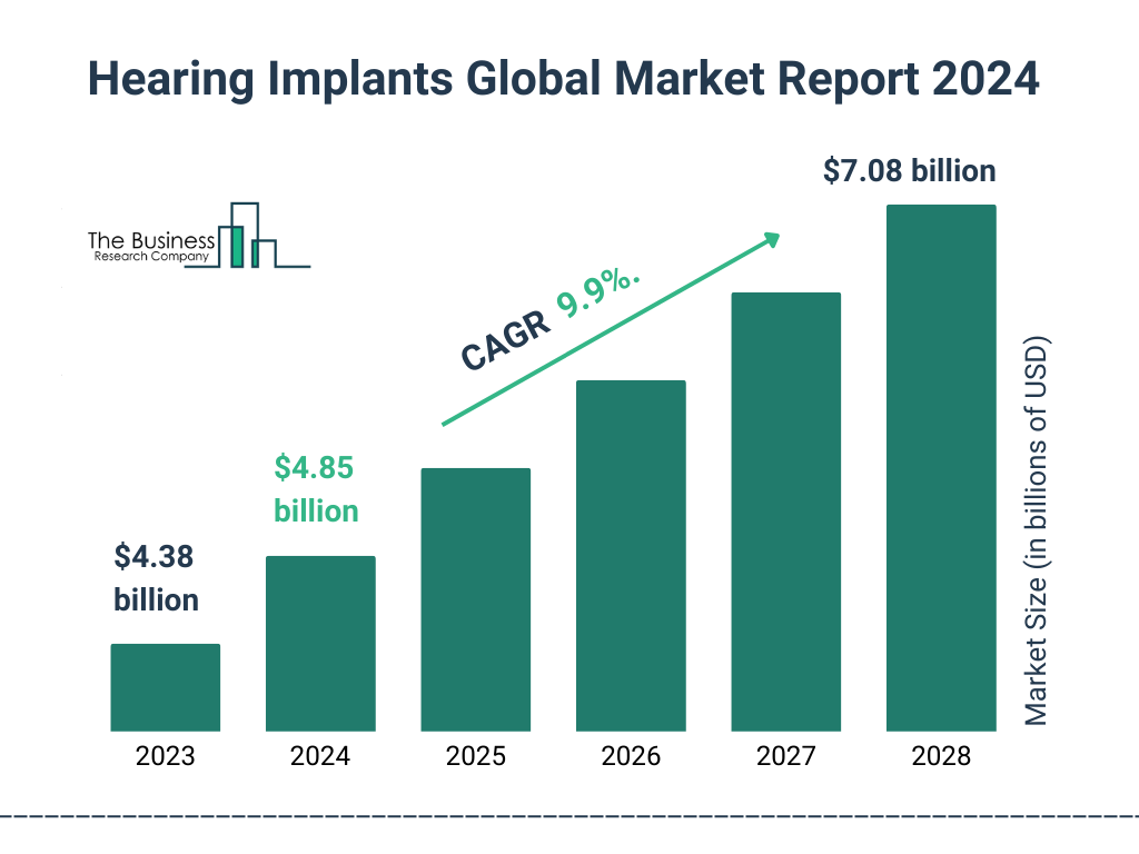 Global Hearing Implants Market Size 2023 to 2028: Graph