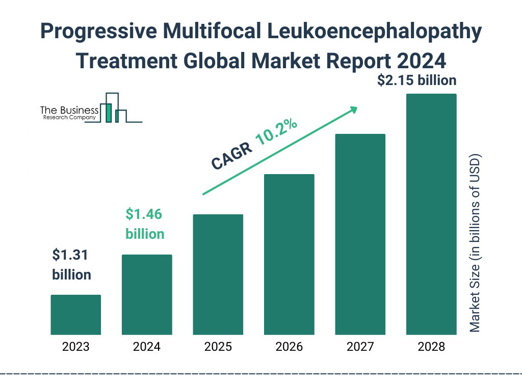 Global Progressive Multifocal Leukoencephalopathy Treatment Market Size 2023 to 2028: Graph