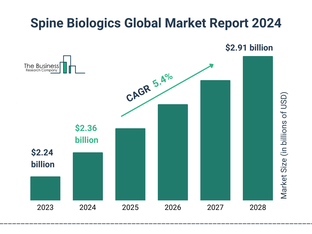 Global Spine Biologics Market Size 2023 to 2028: Graph