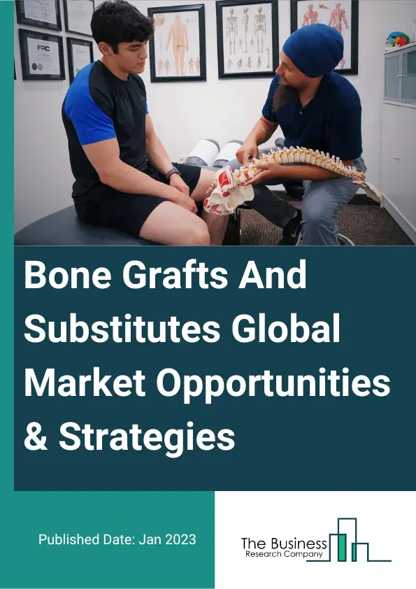 Bone Grafts And Substitutes Market 2023 – By Material (Allograft, Synthetic, Xenograft), By Application (Spinal Fusion, Trauma, Craniomaxillofacial, Joint Reconstruction, Dental Bone Grafting, Other Applications), By End User (Hospitals and Clinics, Surgical Centers, Other End-Users), And By Region, Opportunities And Strategies – Global Forecast To 2032