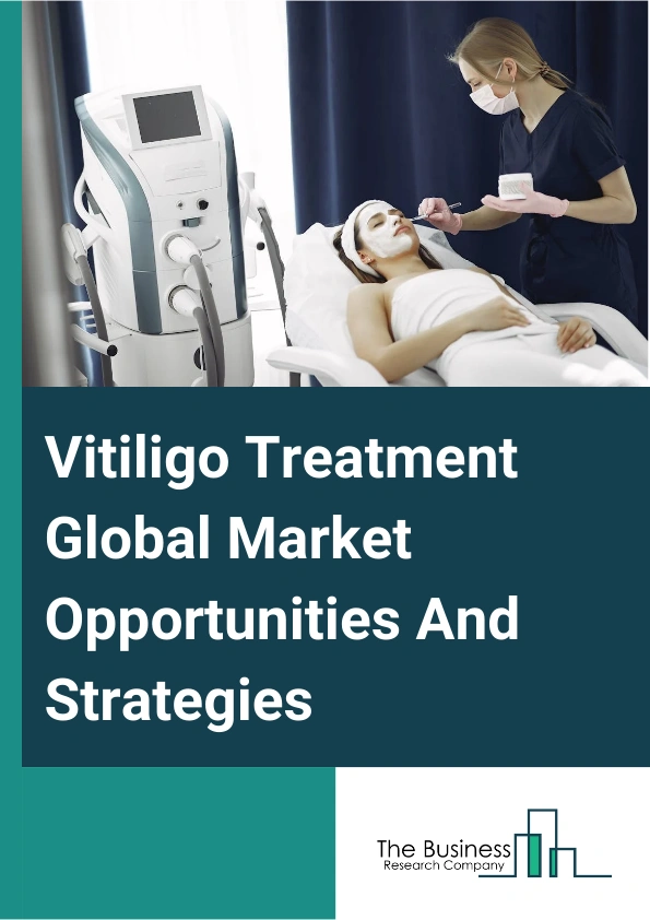 Vitiligo Treatment