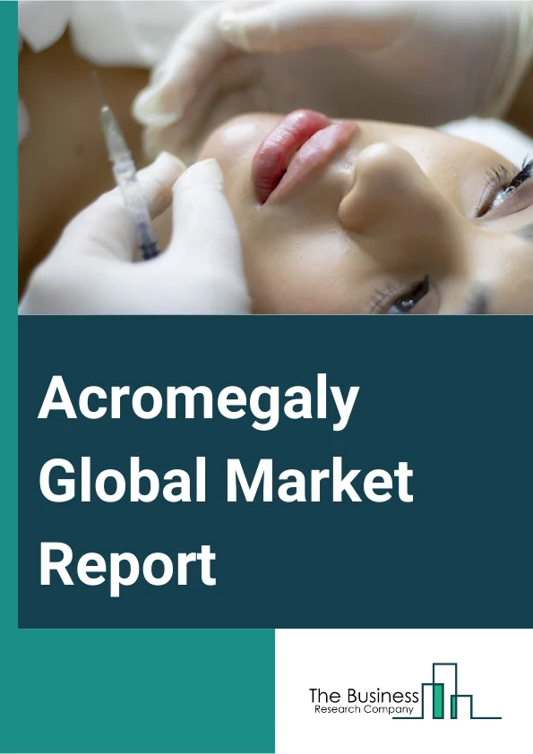 Acromegaly Global Market Report 2024 – By Type (Ectopic Acromegaly, Acromegaly Due To Growth Hormone), By Diagnosis (GH And IGF-I Measurement, Growth Hormone Suppression Test, Imaging, Other Diagnosis), By Route Of Administration (Oral, Parenteral, Other Route Of Administrations), By Treatment (Medication, Somatostatin analogues, Dopamine Agonists, Growth Hormone Antagonist, Surgery, Radiation, Other Treatments), By End Users (Hospitals, Specialty Clinics, Homecare, Other End Users) – Market Size, Trends, And Global Forecast 2024-2033