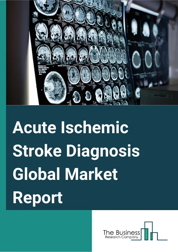 Acute Ischemic Stroke Diagnosis Global Market Report 2024 – By Diagnostic Type (Computed Tomography (CT), Magnetic Resonance Imaging (MRI), Carotid Ultrasound, Cerebral Angiography, Electrocardiography (ECG), Echocardiography, Other Diagnostics), By Surgery Type (Carotid Endarterectomy, Angioplasty, Endovascular Mechanical Thrombectomy), By Application (Tissue Plasminogen Activator (TPA), Anticoagulant, Antiplatelet, Antihypertensive) – Market Size, Trends, And Global Forecast 2024-2033