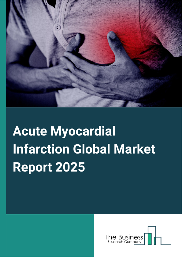 Global Acute Myocardial Infarction Market Report 2025