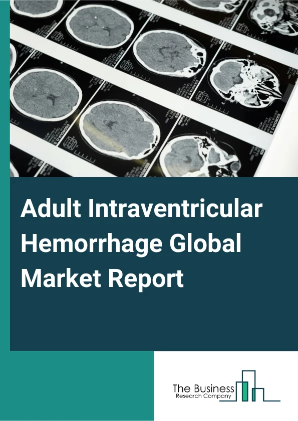 Adult Intraventricular Hemorrhage Global Market Report 2025 – By Product Type (Surgical Devices, Drugs, Monitoring Devices), By Distribution Channel (Direct Sales, Distributors, Online Platforms, Other Distribution Chann...