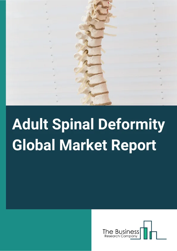 Adult Spinal Deformity Global Market Report 2025 – By Type (Scoliosis, Kyphosis, Lordosis), By Product Type ( Cervical Fixation Devices, Interbody Fusion Devices, Thoracolumbar Devices, Other Product Types), By Procedure...