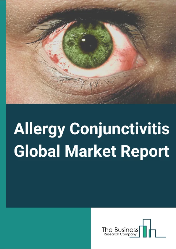 Allergy Conjunctivitis