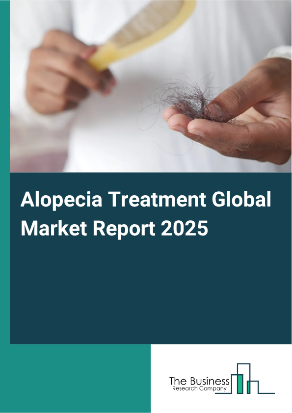 Global Alopecia Treatment Market Report 2025