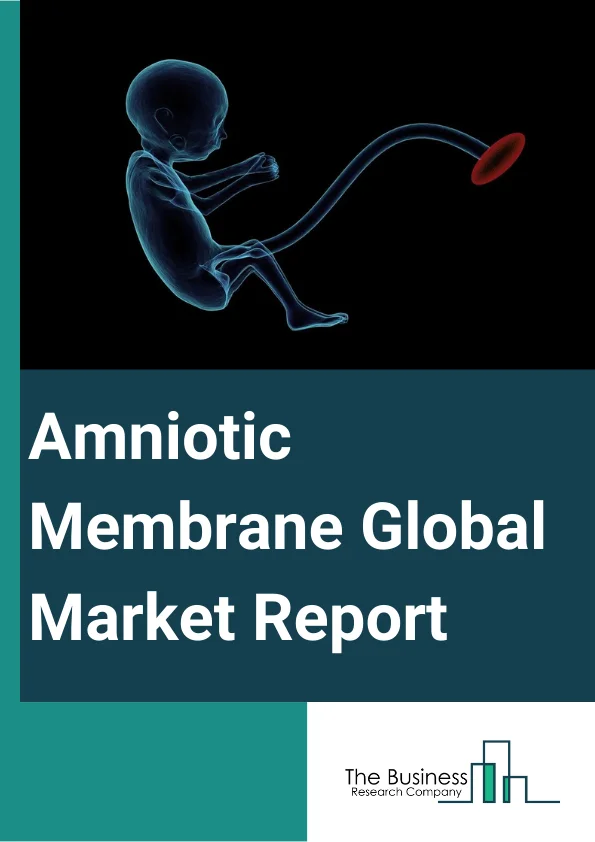 Amniotic Membrane Global Market Report 2025 – By Product (Cryopreserved Amniotic Membrane, Lyophilization Amniotic Membrane), By Application (Surgical Wounds, Ophthalmology, Other Applications), By End-Use (Hospitals, Ambulatory Surgical Centers (ASCs), Other End-Users ) – Market Size, Trends, And Global Forecast 2025-2034