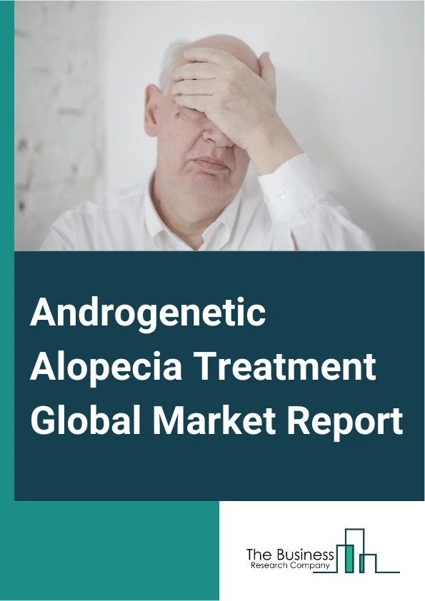 Androgenetic Alopecia Treatment