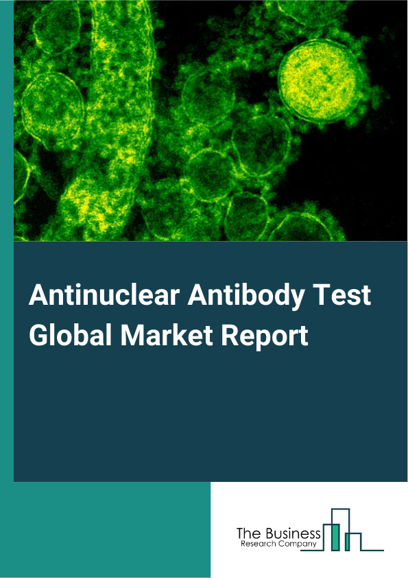 Antinuclear Antibody Test