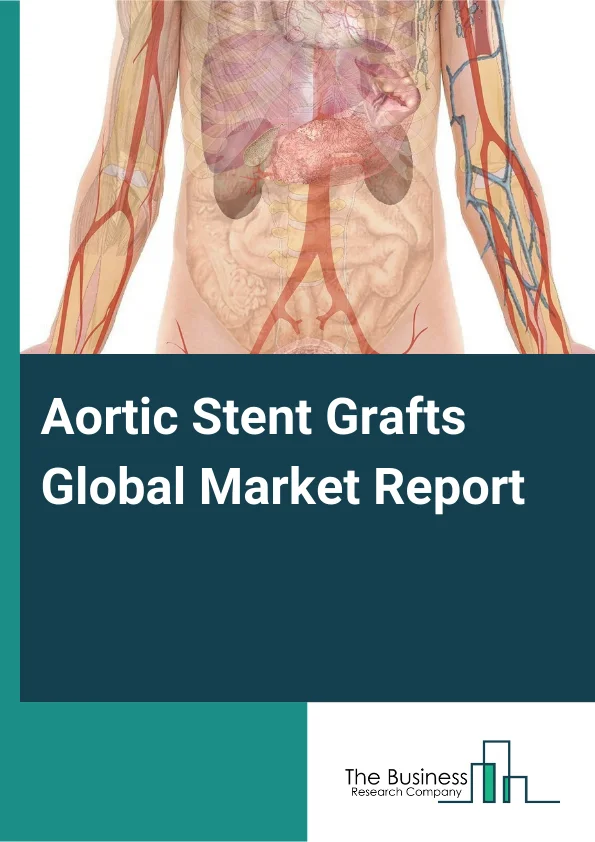 Aortic Stent Grafts Global Market Report 2025 – By Product (Abdominal Aortic Stents Graft, Thoracic Aortic Stents Graft), By Type (Abdominal Aortic Aneurysms, Thoracic Aortic Aneurysms), By End User (Hospitals, Ambulator...