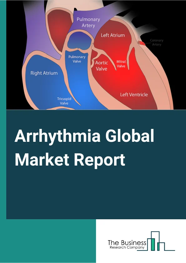 Arrhythmia Global Market Report 2024 – By Type (Supraventricular Tachycardias, Ventricular Arrhythmias, Bradyarrhythmias, Other Types), By Test Equipment (Electrocardiogram (ECG), Holter Monitor), By Hearth blocks (First degree heart block, Second degree heart bloc, Third Degree heart block), By Distribution Channel (Hospitals Pharmacies, Retail Pharmacies, Online Pharmacies) – Market Size, Trends, And Global Forecast 2024-2033