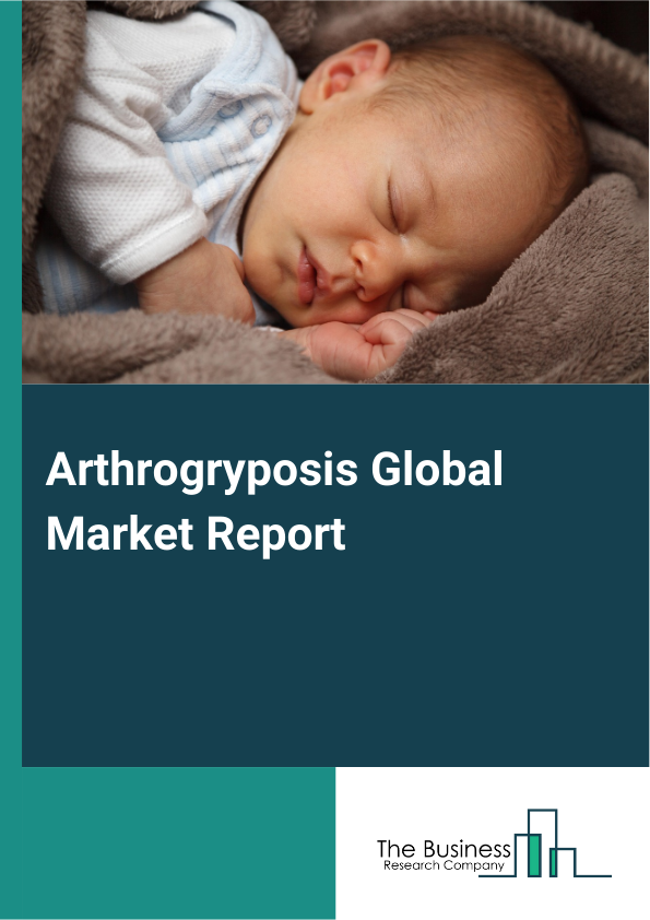 Arthrogryposis