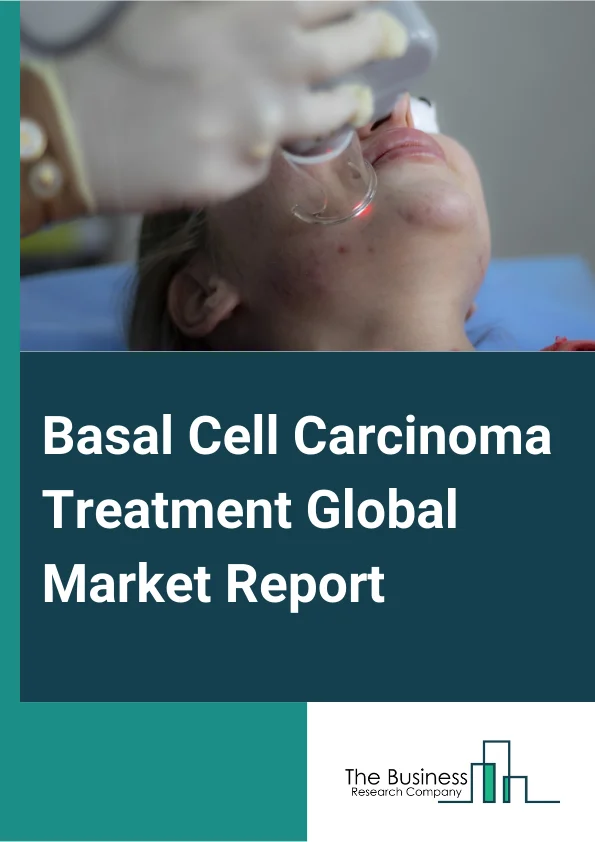 Basal Cell Carcinoma Treatment Global Market Report 2024 – By Treatment (Surgery, Medication, Other Treatments), By Route Of Administration (Oral, Parenteral, Other Route Of Administrations), By Distribution Channel (Hospital Pharmacy, Online Pharmacy, Retail Pharmacy), By End-User (Hospitals, Specialty Clinics, Other End-Users) – Market Size, Trends, And Global Forecast 2024-2033