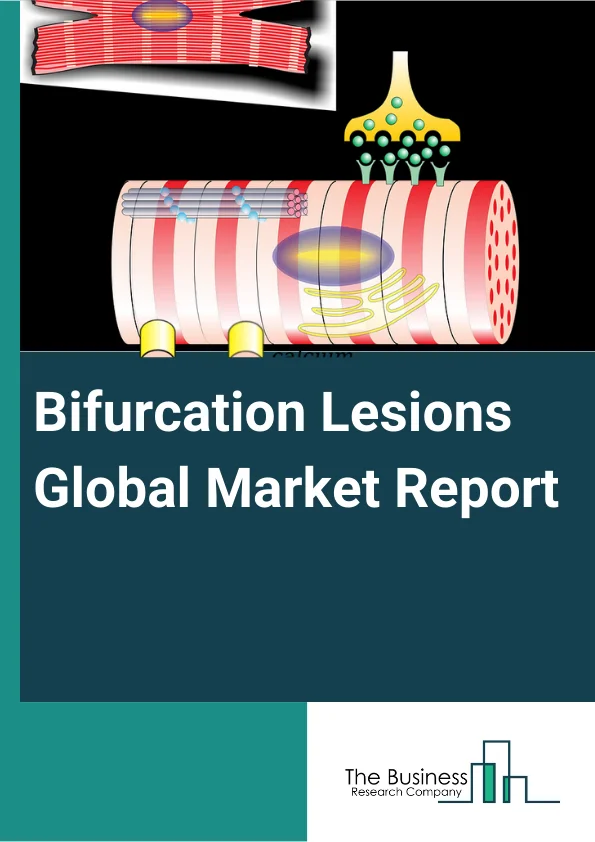 Bifurcation Lesions Global Market Report 2023 – By Types (One Stent, Two Stent), By Application (Coronary Vascular, Peripheral Vascular) – Market Size, Trends, And Global Forecast 2023-2032 