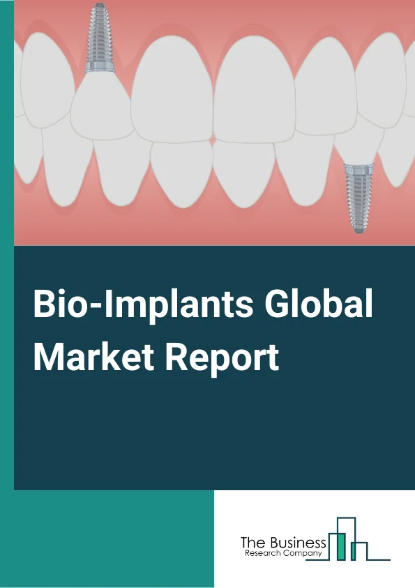 Bio-Implants Global Market Report 2024 – By Type (Cardiovascular Implants, Dental Implants, Spinal Bio-Implants, Orthopedic Implants, Ophthalmic Implants, Other Types), By Material (Metallic, Ceramic, Polymer, Biological), By Origin (Allograft, Autograft, Xenograft, Synthetic), By End-User (Ambulatory Surgical Centers, Clinics, Hospital, Other End-Users) – Market Size, Trends, And Global Forecast 2024-2033