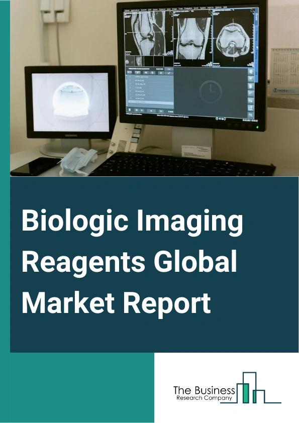 Biologic Imaging Reagents Global Market Report 2025 – By Product (Contrast Reagents, Optical Imaging Reagents, Radiopharmaceuticals), By Modality (Magnetic Resonance Imaging (MRI), Ultrasound, X-Ray And Computerized Tomography (CT), Nuclear, Optical Imaging, Other Modalities), By Application (In Vitro, In Vivo), By End User (Diagnostic Laboratories, Imaging Centers, Life Science Companies, Research And Academic Institutes, Other End Users) – Market Size, Trends, And Global Forecast 2025-2034