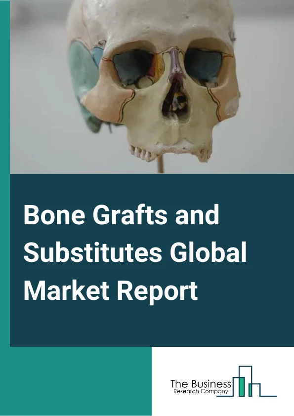 Bone Grafts and Substitutes Global Market Report 2024 – By Material (Allograft, Synthetic, Xenograft), By Application (Spinal Fusion, Trauma, Craniomaxillofacial, Joint Reconstruction, Dental Bone Grafting, Other Applications), By End User (Hospitals and Clinics, Surgical Centers, Other End-Users) – Market Size, Trends, And Global Forecast 2024-2033