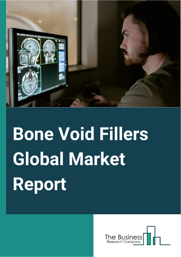Bone Void Fillers Global Market Report 2025 – By Type (Demineralized Bone Matrix, Calcium phosphate Bone Graft Substitute, Collagen Matrix, Other Types), By Form (Gel And Putty, Granules, Other Forms), By Application (Bone Fracture, Spine Fusion, Other Applications), By End-User (Hospital, Specialty Clinics) – Market Size, Trends, And Global Forecast 2025-2034