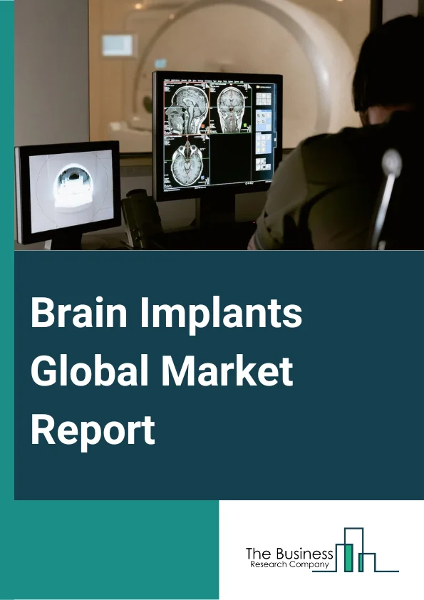 Brain Implants Global Market Report 2024 – By Product (Deep Brain Stimulator, Spinal Cord Stimulator, Vagus Nerve Stimulator), By Application (Chronic Pain, Epilepsy, Parkinson’s Disease, Depression, Essential Tremor, Alzheimer’s Disease), By End User (Hospitals, Neurology Clinics, Other End-Users) – Market Size, Trends, And Global Forecast 2024-2033