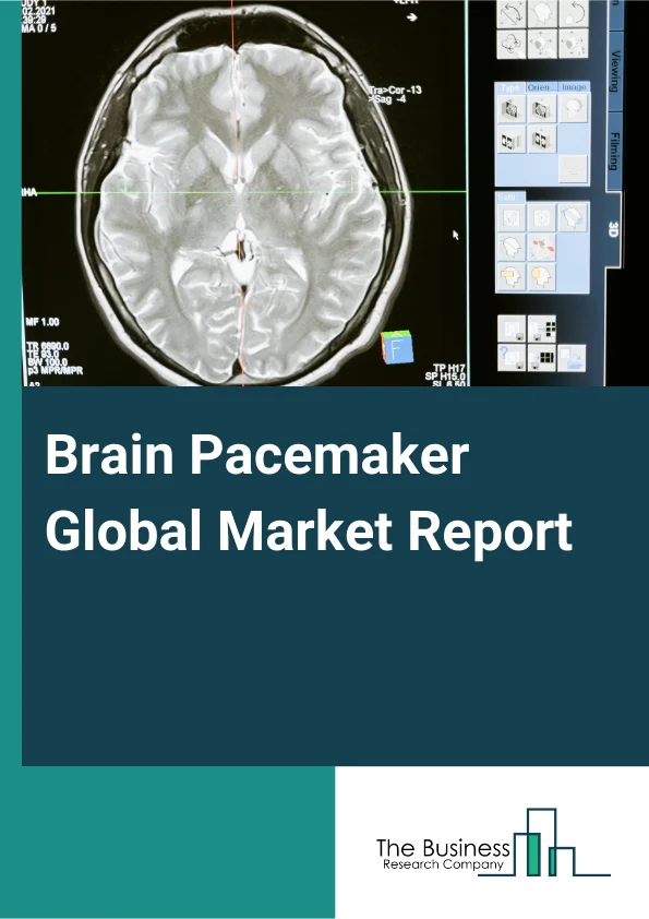 Brain Pacemaker Global Market Report 2025 – By Type (Single Channel, Dual Channel), By Application (Dystonia, Epilepsy, Essential Tremor, Obsessive-Compulsive Disorder, Parkinson's Disease, Other Applications), By Sales Channel (Channel Sales, Direct Sales), By End-User (Hospitals, Ambulatory Surgical Centers And Clinics, Other End-Users) – Impact of Tariff and Trade War on Market Size, Growth, Trends, and Forecast 2025–2034