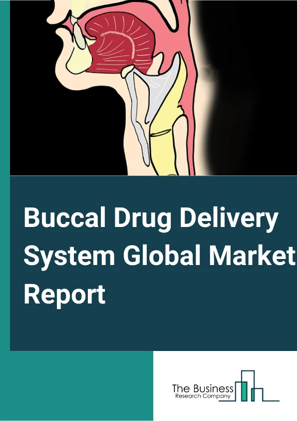 Buccal Drug Delivery System Global Market Report 2025 – By Type (Sublingual, Buccal Tablets and Lozenges, Oral Sprays), By Application (Pain Management, Smoking Cessation, Angina Pectoris), By End-User (Hospitals, Ambulatory Centers, Other End-Users) – Market Size, Trends, And Global Forecast 2025-2034