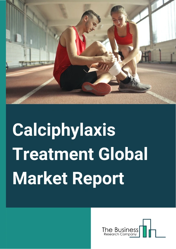 Calciphylaxis Treatment Global Market Report 2024 – By Type (Medication, Hyperbaric Oxygen Therapy, Other Types), By Diagnosis (Imaging, Blood Tests, Deep Skin Biopsies), By End User (Hospitals, Clinics, Medical Research Centers, Academic Institutes) – Market Size, Trends, And Global Forecast 2024-2033