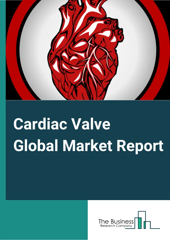 Cardiac Valve