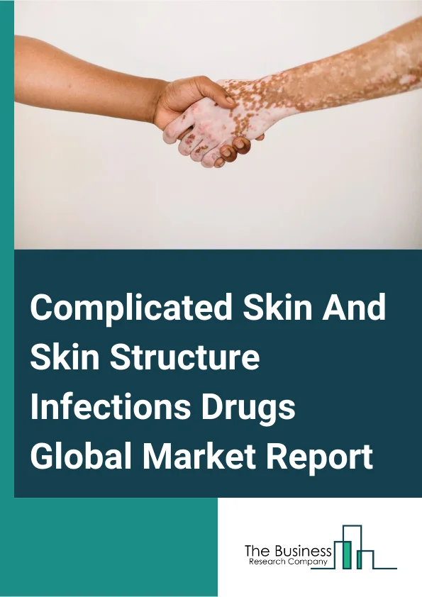 Complicated Skin And Skin Structure Infections Drugs Global Market Report 2025 – By Active Ingredients (Delafloxacin, Vancomycin, Ceftaroline Fosamil, Linezolid, Other Active Ingredients), By Route of Administration (Oral, Topical, Parenteral), By End User (Hospitals, Homecare, Specialty Clinics, Other End-Users) – Market Size, Trends, And Global Forecast 2025-2034