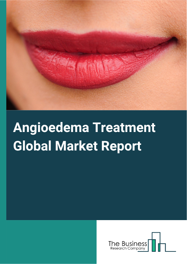 Angioedema Treatment Global Market Report 2025 - By Type (Allergic Angioedema, Drug-Induced Angioedema, Idiopathic Angioedema, Hereditary Angioedema), By Route Of Administration (Injection, Oral), By End Use (Hospitals, Clinics, Research Organizations) - Market Size, Trends, And Global Forecast 2025-2034