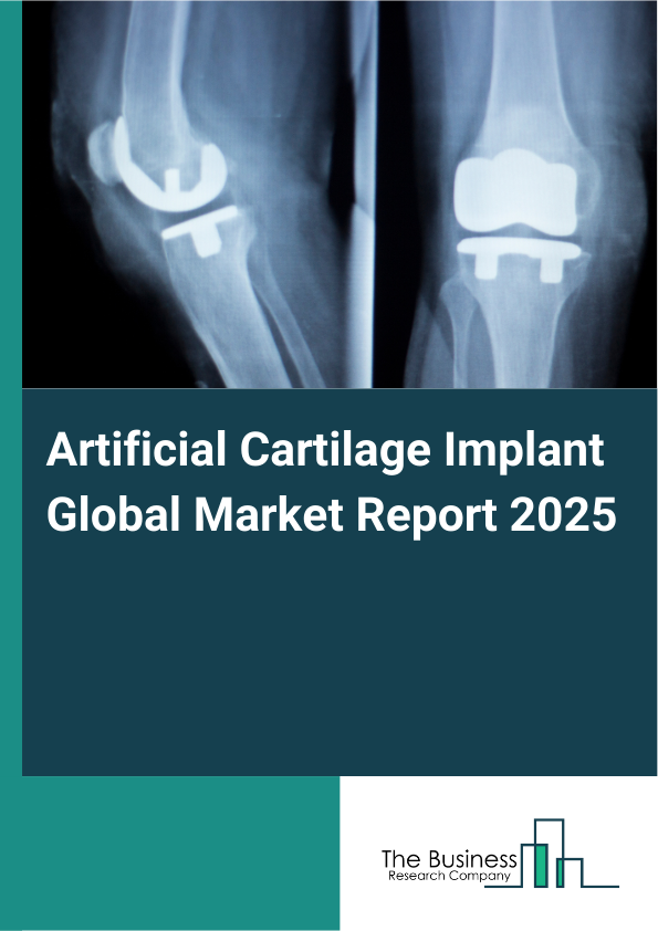 Artificial Cartilage Implant Global Market Report 2025 - By Type Of Implant (Biological Implants, Synthetic Implants, Composite Implants, Smart Implants), By Product Type (Upper Extremity Joints, Lower Extremity Joints, Vertebral Joints), By Distribution Channel (Direct Sales, Online Retail, Distributors, Specialty Clinics), By Application (Knee Replacement, Hip Replacement, Shoulder Reconstruction, Ankle Replacement), By End-User (Hospitals, Orthopedic Clinics, Ambulatory Surgical Centers, Research Institutes, Other End-Users) - Market Size, Trends, And Global Forecast 2025-2034