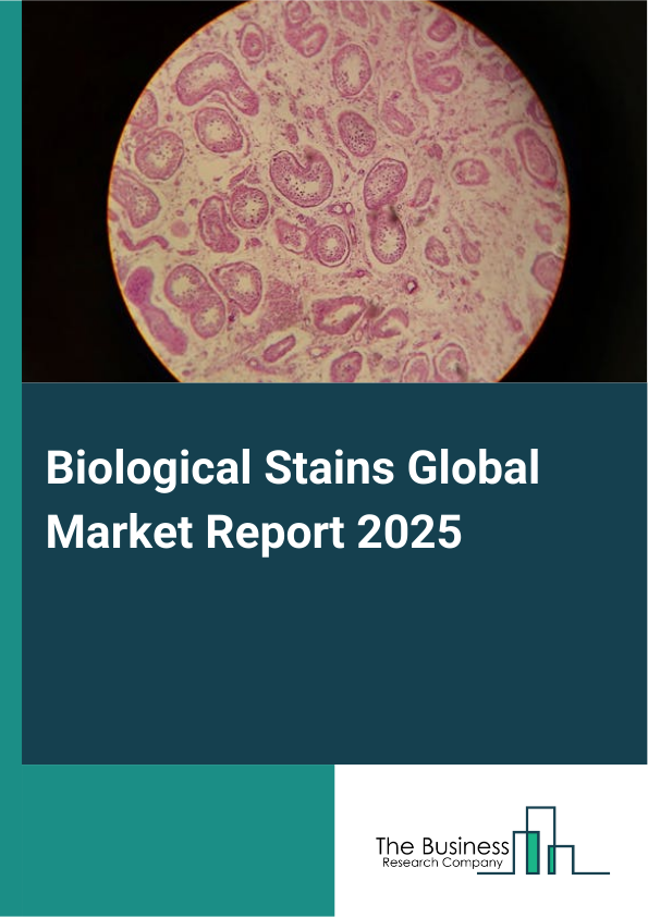 Biological Stains Global Market Report 2025 - By Nature (Acidic Stains, Basic Stains, Neutral Stains), By Product Type (Acid Fuchsin, Congo Red, Crystal Violet, Eosin, Other Product Types), By Application (Histology And Cytology, Microbiology, Bacteriology, Deoxyribonucleic Acid Staining, Protein Staining, Gram Staining, Other Applications), By End-User (Diagnostic Laboratories, Academic And Research Institutes, Pharmaceutical And Biotechnology Companies, Other End-Users) - Market Size, Trends, And Global Forecast 2025-2034