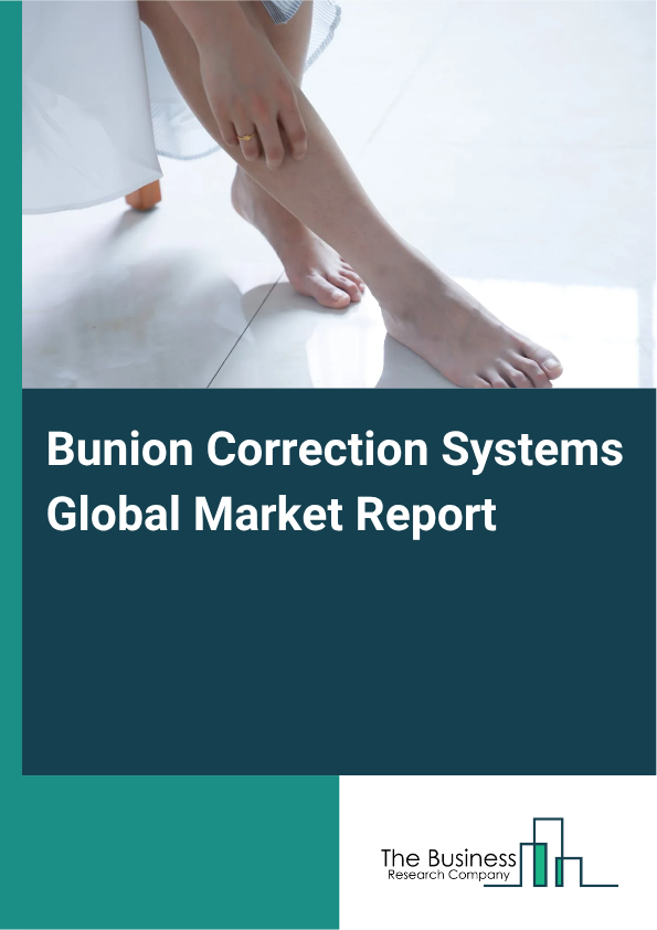 Bunion Correction Systems Global Market Report 2025 - By Type (Osteotomy, Arthrodesis, Lapidus, Exostectomy), By Product Type (Correction Systems, Implants And Accessories, Wearables), By Surgery Type (Minimally Invasive, Traditional), By End-Use (Hospitals, Ambulatory Centers, Specialty Centers) - Market Size, Trends, And Global Forecast 2025-2034