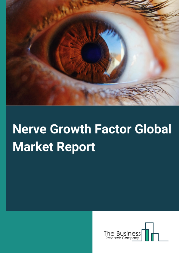 Nerve Growth Factor Global Market Report 2025 - By Type (Alpha-Nerve Growth Factor (NGF), Beta-Nerve Growth Factor (NGF), Gamma-Nerve Growth Factor (NGF), Other Types), By Agents (Cenegermin, Other Agents), By Indication (Neurodegenerative Disorders, Spinal Cord Injuries, Eye Disorders, Epithelial Diseases, Tissue Healing, Other Indications), By Distribution Channel (Hospital Pharmacy, Online Pharmacy, Retail Pharmacy), By End-User (Hospitals, Homecare, Specialty Clinics, Other End-Users) - Market Size, Trends, And Global Forecast 2025-2034