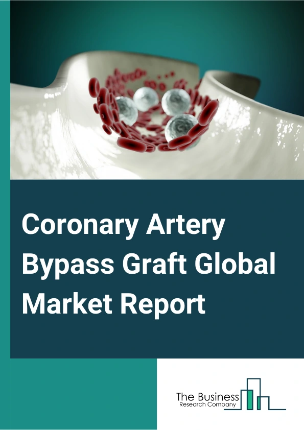 Coronary Artery Bypass Graft Global Market Report 2025 – By Procedure (Single Coronary Artery Bypass Graft (CABG) Surgery, Double Coronary Artery Bypass Graft (CABG) Surgery, Triple Coronary Artery Bypass Graft (CABG) Su...
