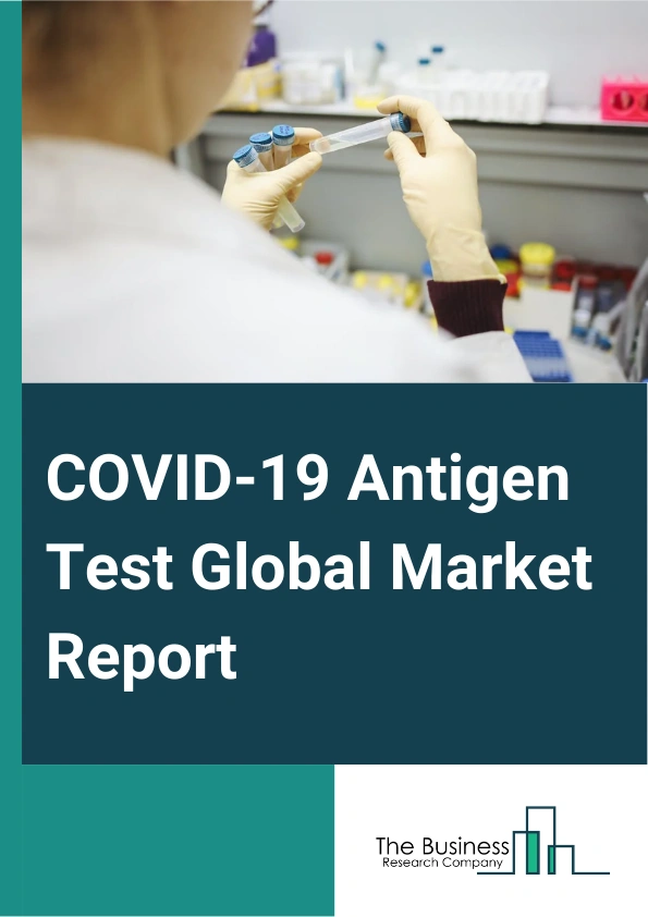 COVID-19 Antigen Test Global Market Report 2024 – By Product And Service (Platforms, Reagents And Kits, Services), By Specimen Type (Nasopharyngeal Swab, Oropharyngeal Swab, Nasal Swab), By End-Use (Clinics And Hospitals, Home Care, Diagnostic Labs, Other End-Uses) – Market Size, Trends, And Global Forecast 2024-2033