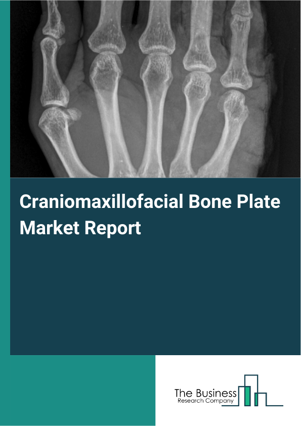 Craniomaxillofacial Bone Plate Market Report Infographic Image