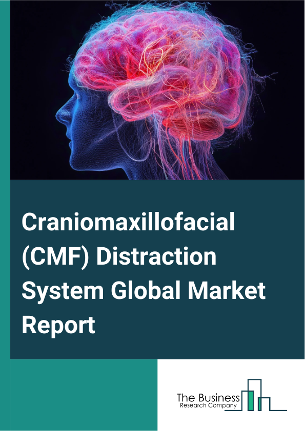 Global Craniomaxillofacial (CMF) Distraction System Market Report 2025