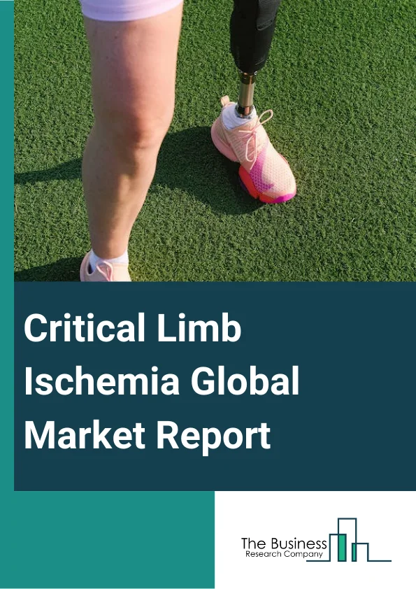 Critical Limb Ischemia Global Market Report 2024 – By Type (Devices, Drugs, Surgery), By Medication (Antihypertensive Agents, Antiplatelet Drugs, Antithrombotic Agents, Other Medications), By Application (Hospital, Clinic, Other Applications) – Market Size, Trends, And Global Forecast 2024-2033