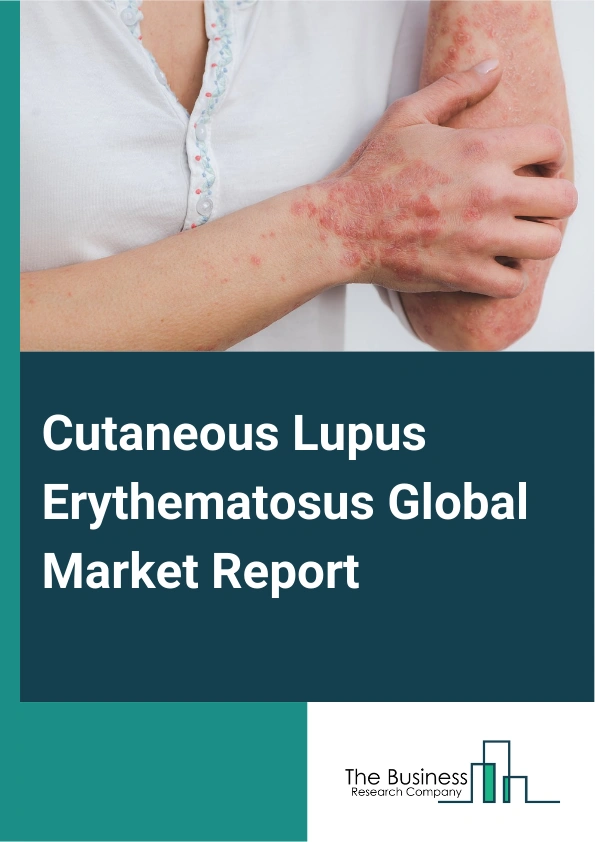 Global Cutaneous Lupus Erythematosus Market Report 2025