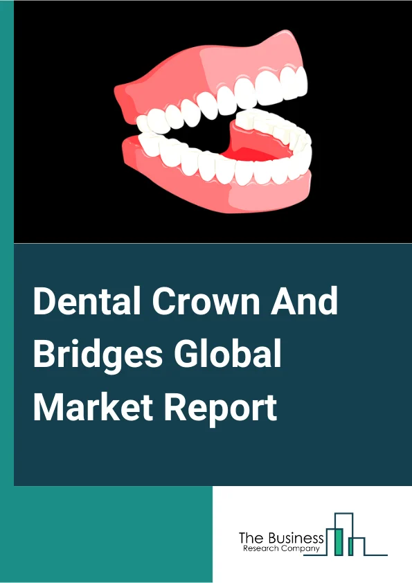 Dental Crown And Bridges