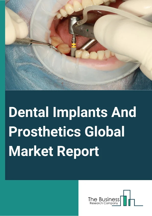 Dental Implants And Prosthetics Global Market Report 2025 – By Product Type (Dental Bridges, Dental Implants, Dental Crown, Abutment, Dentures, Inlays and Onlays, Other Products), By Design (Tapered Dental Implants, Parallel-Walled Dental Implants), By Material (Titanium, Zirconium, Metal, Ceramic, Other Materials), By Price (Premium Implants, Value Implants, Discounted Implants), By End-User (Dental Hospital And Clinics, Dental Laboratories, Other End-Users) – Impact of Tariff and Trade War on Market Size, Growth, Trends, and Forecast 2025–2034