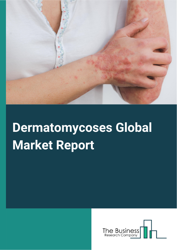 Dermatomycoses
