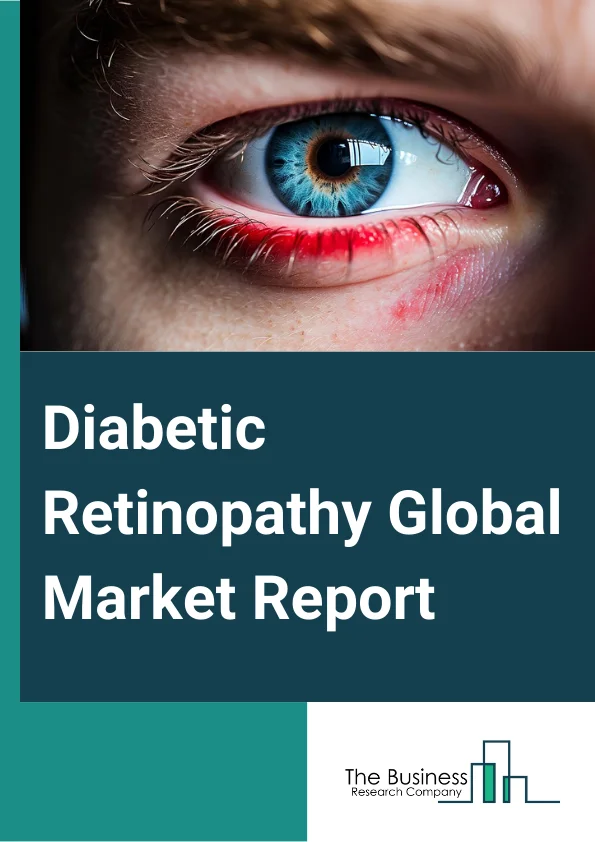 Diabetic Retinopathy Global Market Report 2025 – By Type (Proliferative Diabetic Retinopathy, Non-Proliferative Diabetic Retinopathy), By Treatment (Anti-VEGF Drugs, Intraocular Steroid Injection, Laser Photocoagulation, Vitreoretinal Surgery), By End-User (Hospitals, Ambulatory Surgical Centers, Other End Users) – Market Size, Trends, And Global Forecast 2025-2034