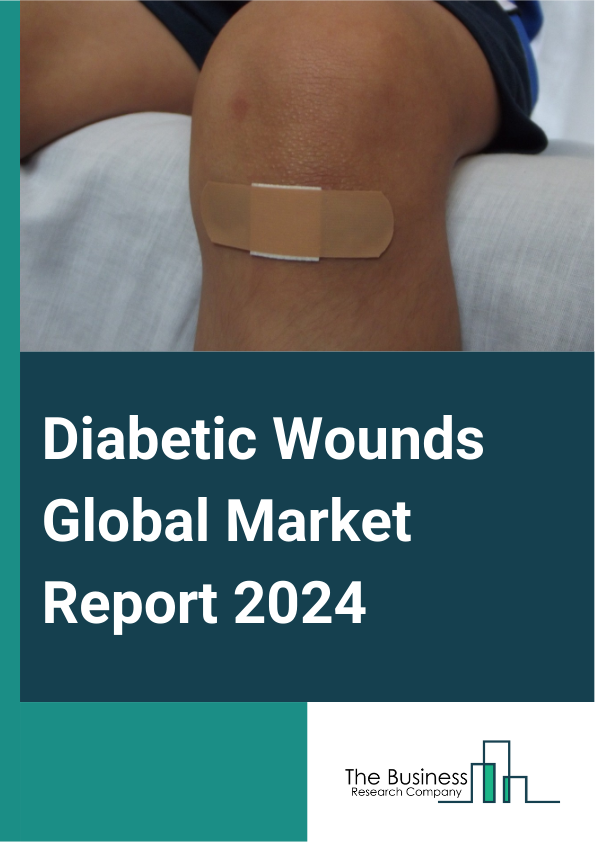 Diabetic Wounds Global Market Report 2025 – By Product Type (Wound Care Dressings, Wound Care Devices, Skin Grafts And Substitutes, Growth Factors, Other Products), By Wound Type (Neuropathic Ulcer Wounds, Ischemic Ulcer...