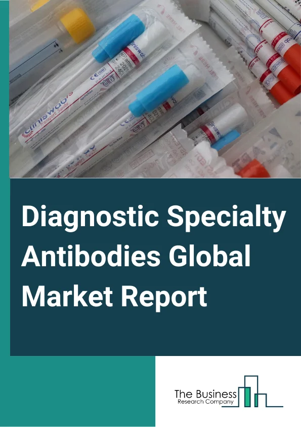 Diagnostic Specialty Antibodies Global Market Report 2025 – By Antibody Type (Monoclonal Antibodies, Polyclonal Antibodies, Recombinant Polyclonal Antibodies), By Application (Hepatitis, Tuberculosis, Dengue, Oncology, Human Immunodeficiency Virus (HIV), Infectious Disease, Other Applications), By End User (Diagnostic Laboratories, Hospitals) – Market Size, Trends, And Global Forecast 2025-2034