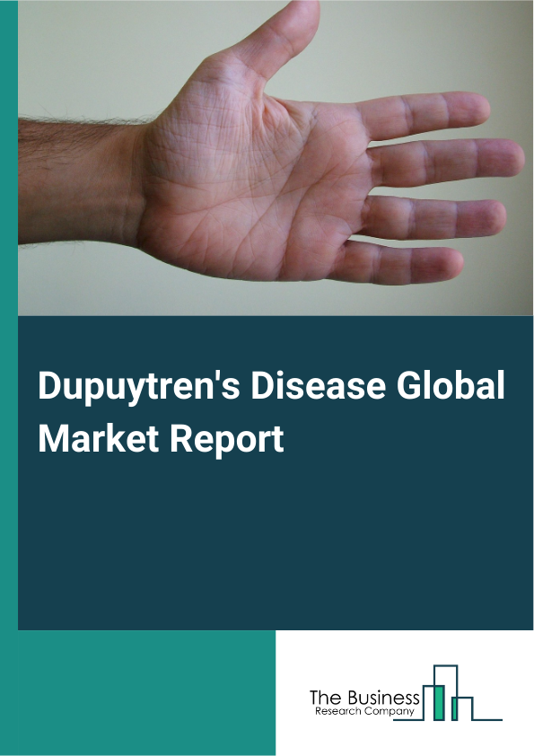 Dupuytrens Disease